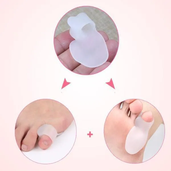 Bunionette Corrector for Tailor’s Bunion and Toe Alignment